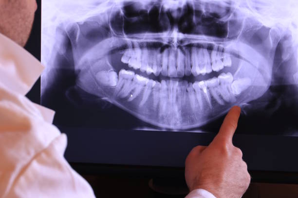 Reliable CA Emergency Dental Service Solutions