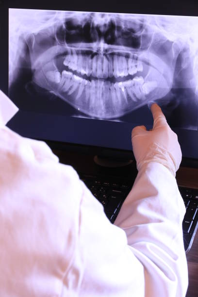 Best Emergency Denture Repair in Temple City, CA